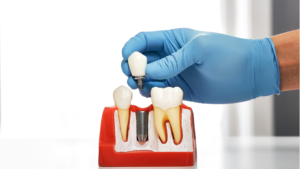 Periimplantitis